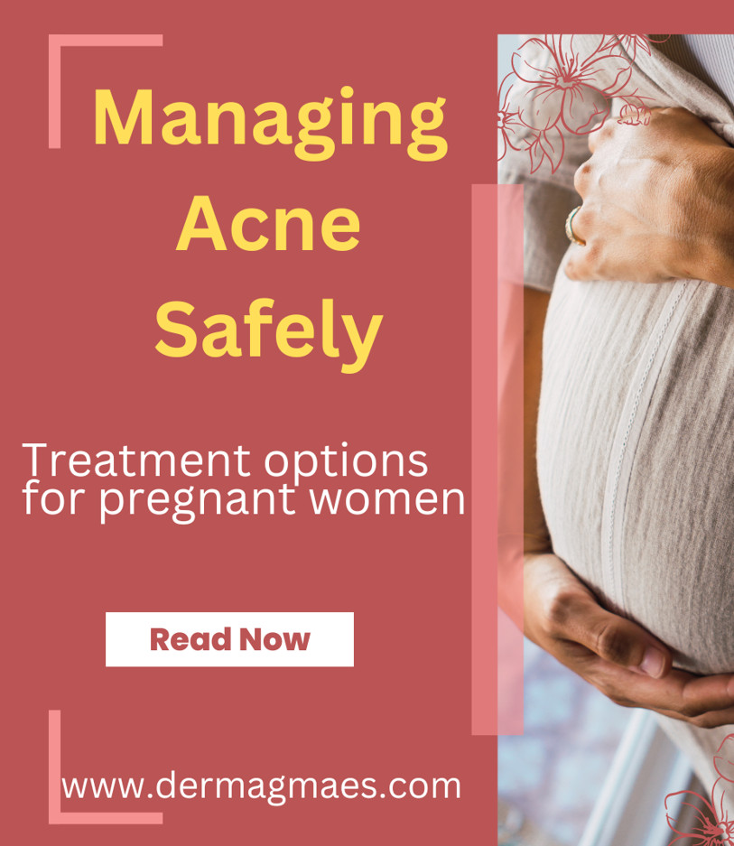 acne in pregnancy